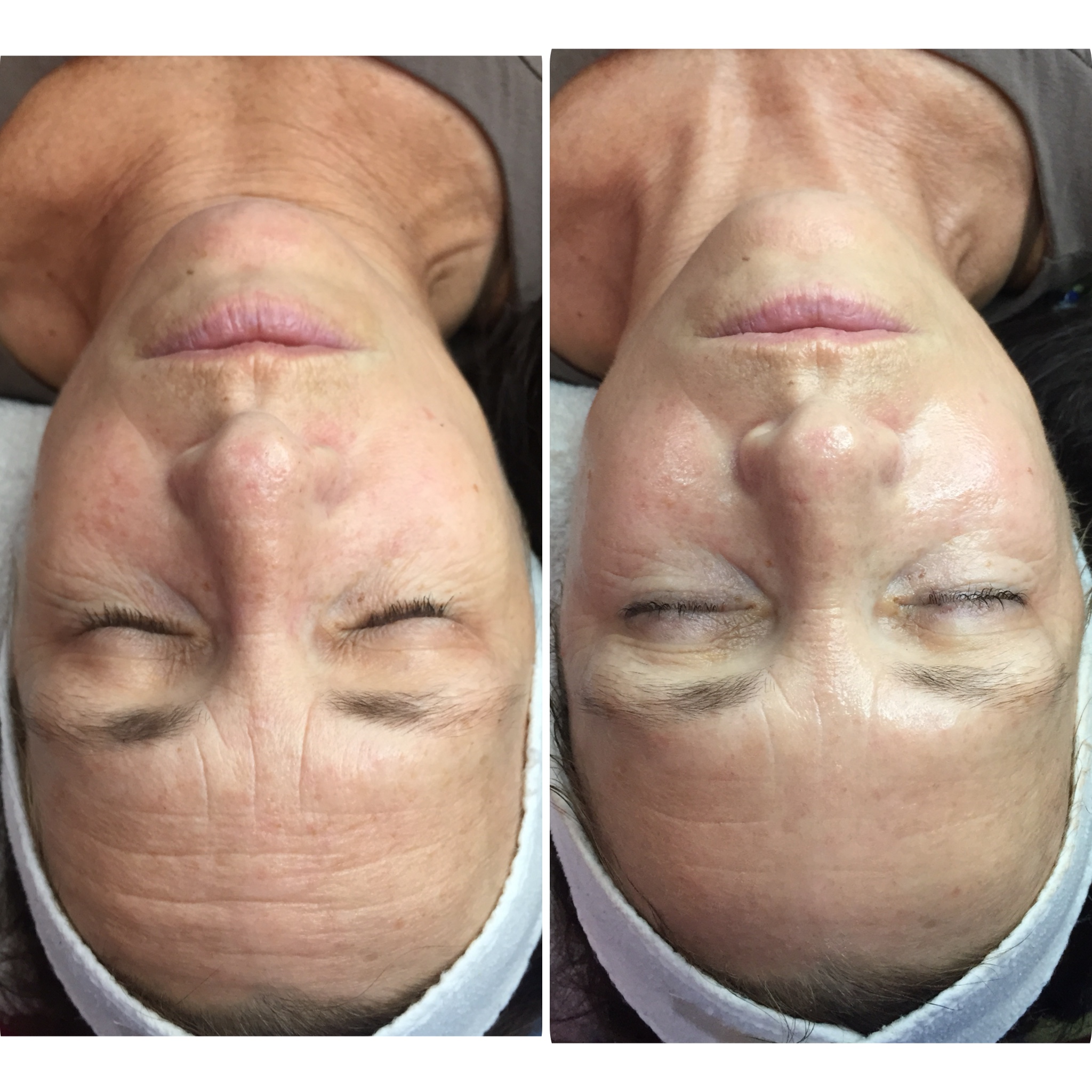 Lourdes experience em cascais apenas na Lourdes Estetica