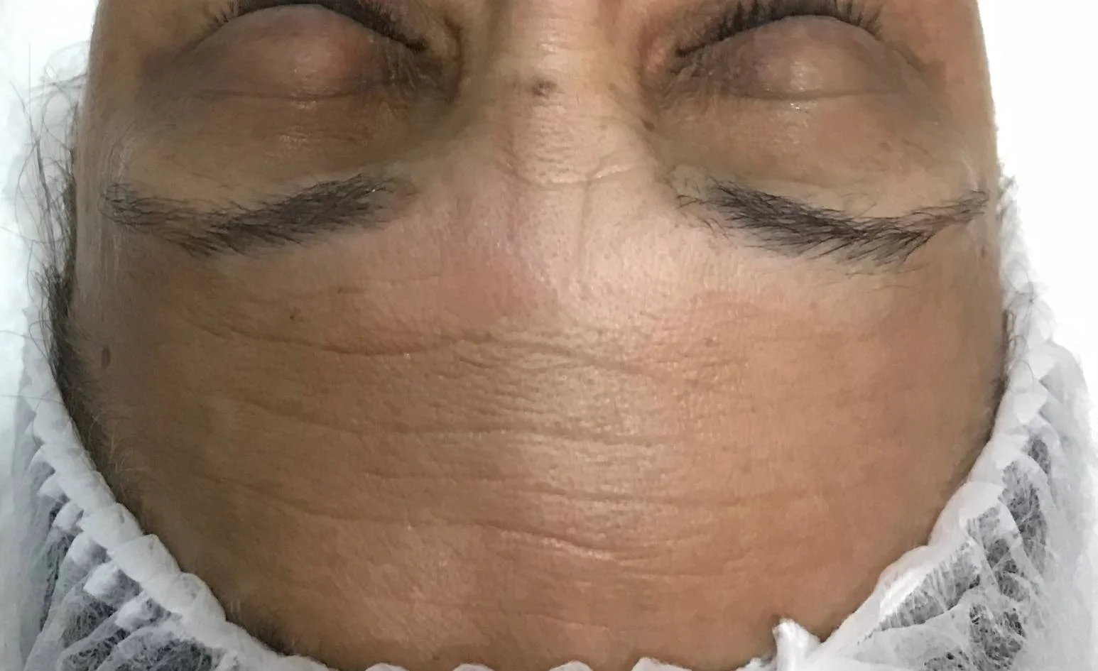 Lourdes Estetica em Cascais- Feedback