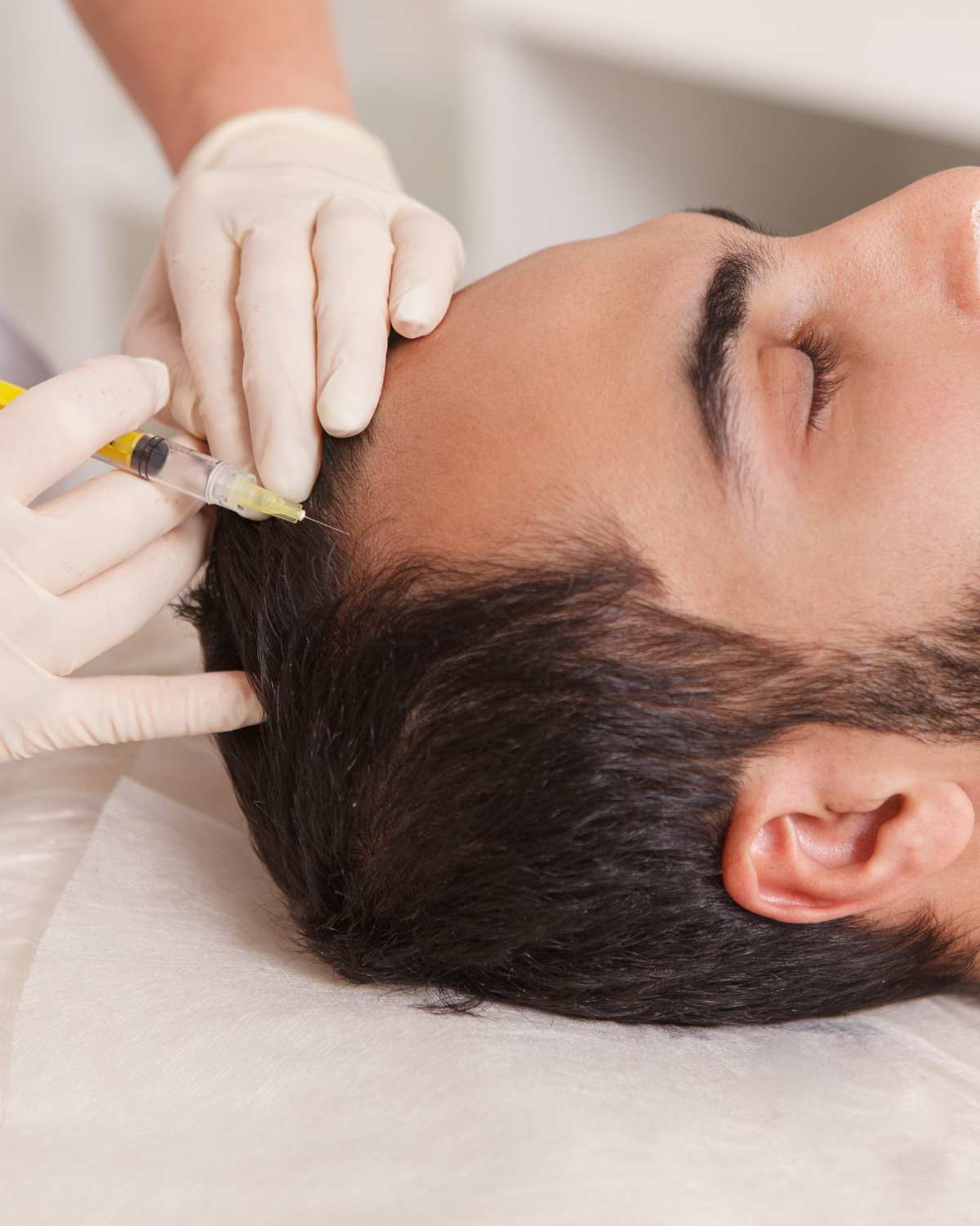 Tratamento para alopecia na Lourdes Estética em Cascais.