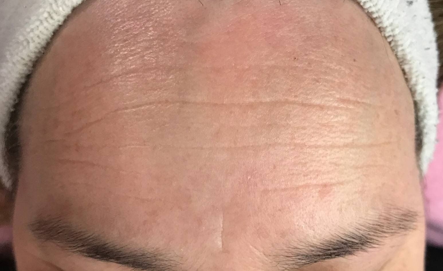 Lourdes Estetica em Cascais- Feedback