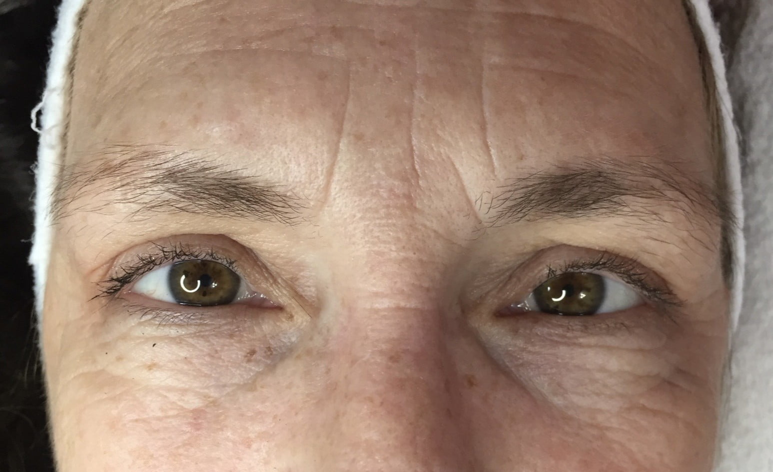 antes ojos