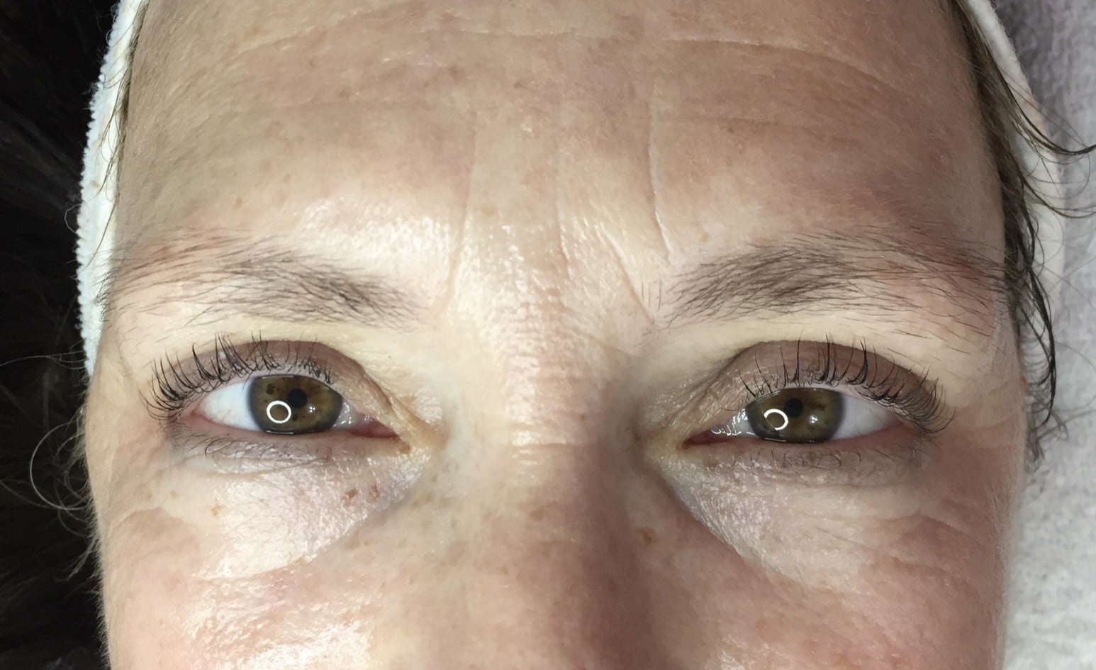 despues ojos