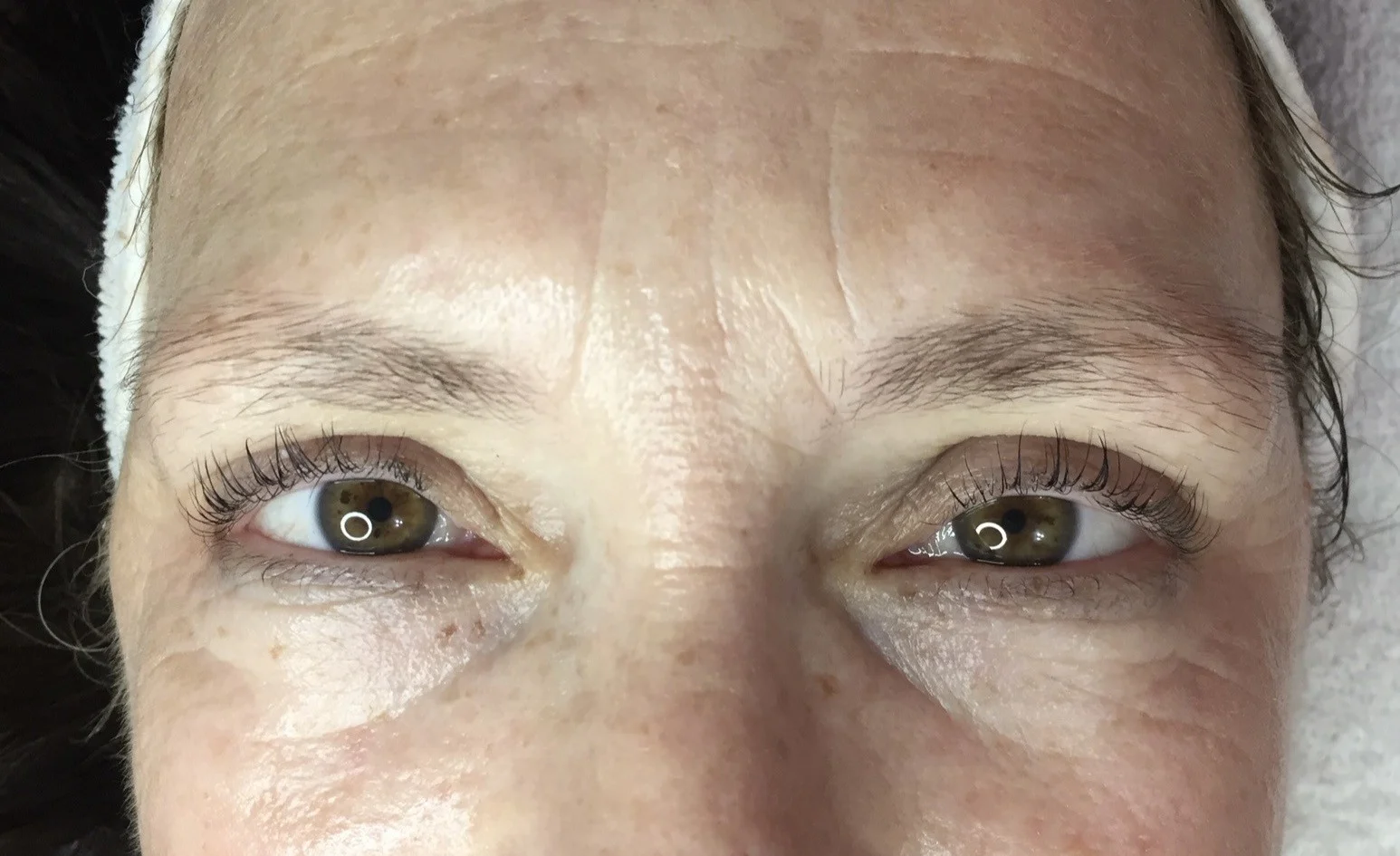 despues ojos