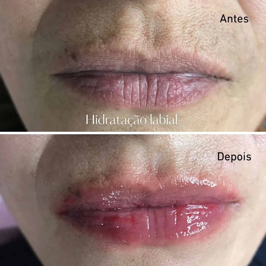 Resultado completo do Pack Olhar e Lábios - pestanas curvadas e lábios radiantes em Cascais - Lourdes Estética