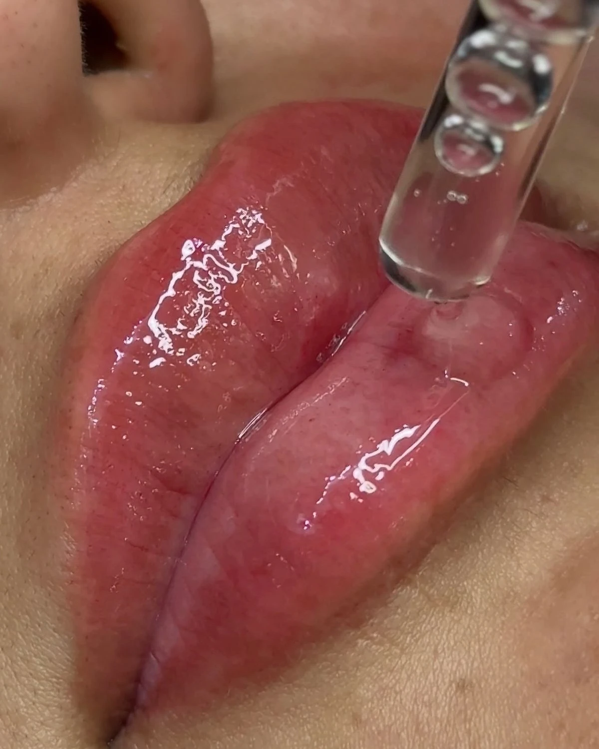 Hidratação labial BB Lips em Cascais - lábios hidratados e com cor natural na Lourdes Estética