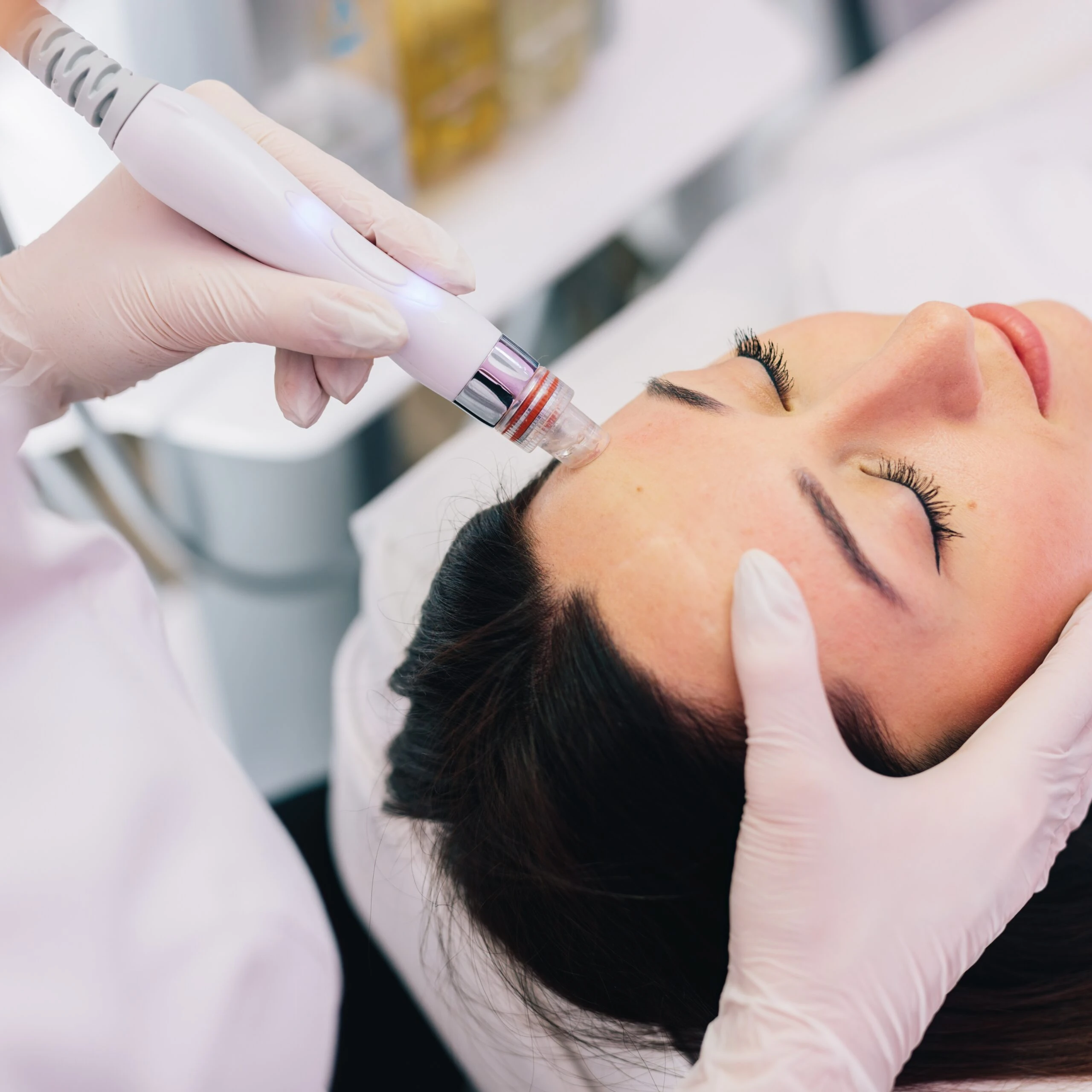 Limpeza facial profissional em Cascais - Lourdes Estetica