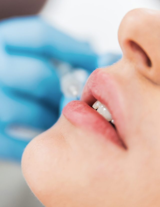 Hidratação Labial BB Lips em Cascais | Lourdes Estética